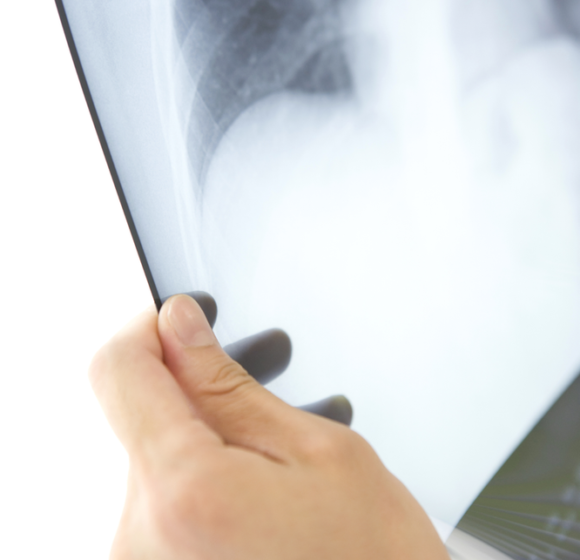 Chronic Kidney Disease in Cats Chronic Kidney Disease in Cats.Oxford Cat Clinic, Botley & Marston.